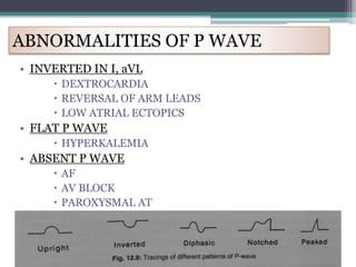 ABNORMALITIES OF P WAVE
• INVERTED IN I, aVL
 DEXTROCARDIA
 REVERSAL OF ARM LEADS
 LOW ATRIAL ECTOPICS
• FLAT P WAVE
 HYPERKALEMIA
• ABSENT P WAVE
 AF
 AV BLOCK
 PAROXYSMAL AT
 