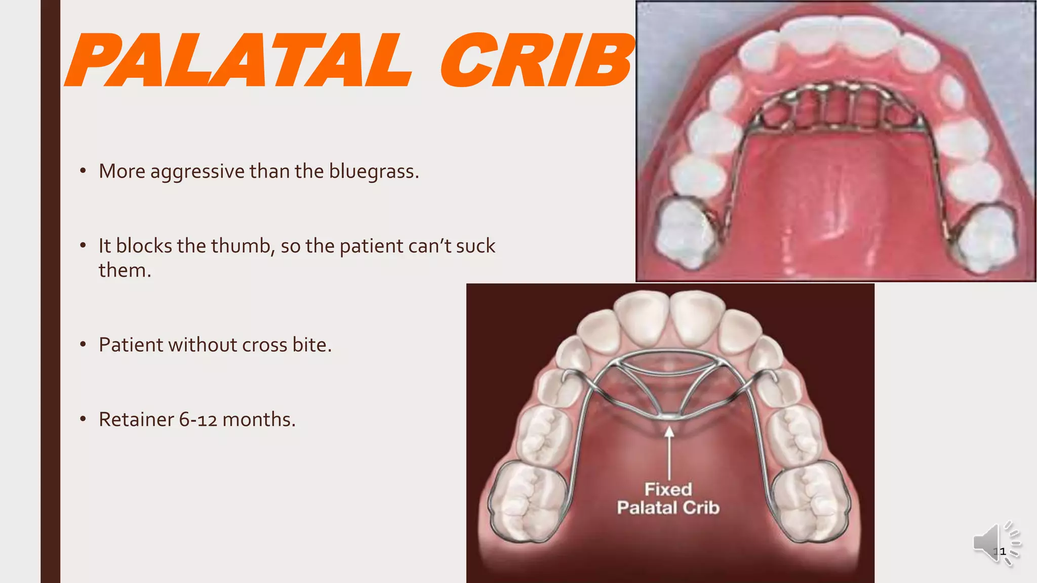 Crib Or Rake Habit breaking appliances | PPT | Free Download