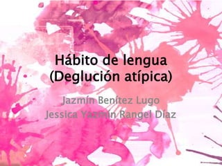 Hábito de lengua
(Deglución atípica)
Jazmín Benítez Lugo
Jessica Yazmín Rangel Díaz
 