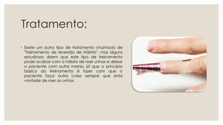 Tratamento:
◦ Existe um outro tipo de tratamento chamado de
"Treinamento de reversão de Hábito", mas alguns
estudiosos dizem que este tipo de treinamento
pode acabar com o hábito de roer unhas e deixar
o paciente com outra mania, já que o princípio
básico do treinamento é fazer com que o
paciente faça outra coisa sempre que sinta
vontade de roer as unhas.
 