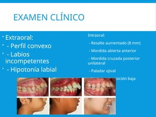 habito_succion_digital[1].pptx ortodoncia inicial | PPTX