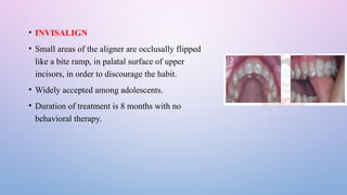 Invislain Ramps ORAL habits IN ORTHODONTICS AND ,MANAGEMENT .pptx