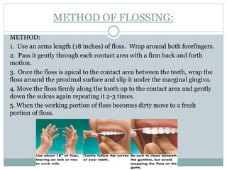 METHOD OF FLOSSING:
METHOD:
1. Use an arms length (18 inches) of floss. Wrap around both forefingers.
2. Pass it gently through each contact area with a firm back and forth
motion.
3. Once the floss is apical to the contact area between the teeth, wrap the
floss around the proximal surface and slip it under the marginal gingiva.
4. Move the floss firmly along the tooth up to the contact area and gently
down the sulcus again repeating it 2-3 times.
5. When the working portion of floss becomes dirty move to a fresh
portion of floss.
 