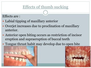 Effects of thumb sucking
Effects are :
 Labial tipping of maxillary anterior
 Overjet increases due to proclination of maxillary
anterior.
 Anterior open biting occurs as restriction of incisor
eruption and supraeruption of buccal teeth
 Tongue thrust habit may develop due to open bite
 