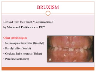 HABITS IN ORTHODONTICS.ppt