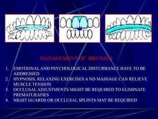 MANAGEMENT OF BRUXISM
1. EMOTIONALAND PSYCHOLOGICAL DISTURBANCE HAVE TO BE
ADDRESSED
2. HYPNOSIS, RELAXING EXERCISES A ND MASSAGE CAN RELIEVE
MUSCLE TENSION
3. OCCLUSAL ADJUSTMENTS MIGHT BE REQUIRED TO ELIMINATE
PREMATURATIES
4. NIGHT GUARDS OR OCCLUSAL SPLINTS MAY BE REQUIRED
 