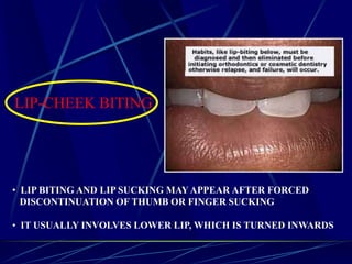 LIP-CHEEK BITING
• LIP BITING AND LIP SUCKING MAY APPEAR AFTER FORCED
DISCONTINUATION OF THUMB OR FINGER SUCKING
• IT USUALLY INVOLVES LOWER LIP, WHICH IS TURNED INWARDS
 