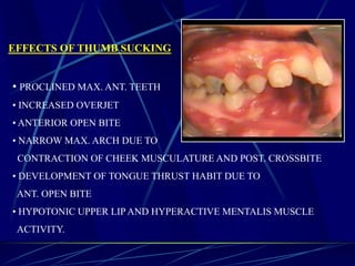 EFFECTS OF THUMB SUCKING
• PROCLINED MAX. ANT. TEETH
• INCREASED OVERJET
• ANTERIOR OPEN BITE
• NARROW MAX. ARCH DUE TO
CONTRACTION OF CHEEK MUSCULATURE AND POST. CROSSBITE
• DEVELOPMENT OF TONGUE THRUST HABIT DUE TO
ANT. OPEN BITE
• HYPOTONIC UPPER LIP AND HYPERACTIVE MENTALIS MUSCLE
ACTIVITY.
 