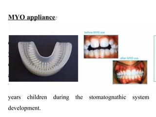 Comprehensive Overview of Oral Habits in Infants and Children: Causes ...