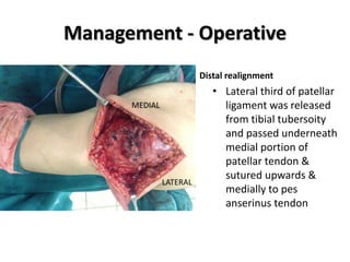 Management - Operative 
Distal realignment 
• Lateral third of patellar 
ligament was released 
from tibial tubersoity 
an...