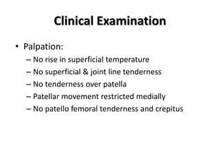 Clinical Examination 
• Palpation: 
– No rise in superficial temperature 
– No superficial & joint line tenderness 
– No t...