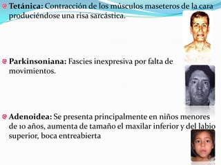 Tetánica: Contracción de los músculos maseteros de la cara
produciéndose una risa sarcástica.




Parkinsoniana: Fascies inexpresiva por falta de
movimientos.




Adenoidea: Se presenta principalmente en niños menores
de 10 años, aumenta de tamaño el maxilar inferior y del labio
superior, boca entreabierta
 