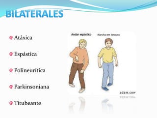 Atáxica

Espástica

Polineurítica

Parkinsoniana

Titubeante
 