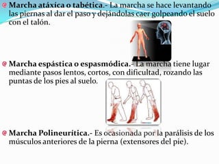 Marcha atáxíca o tabética.- La marcha se hace levantando
las piernas al dar el paso y dejándolas caer golpeando el suelo
con el talón.




Marcha espástica o espasmódica.- La marcha tiene lugar
mediante pasos lentos, cortos, con dificultad, rozando las
puntas de los pies al suelo.




Marcha Polineurítica.- Es ocasionada por la parálisis de los
músculos anteriores de la pierna (extensores del pie).
 