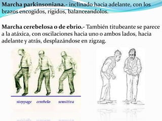 Marcha parkinsoniana.- inclinado hacia adelante, con los
brazos encogidos, rígidos, balanceandolos.

Marcha cerebelosa o de ebrio.- También titubeante se parece
a la atáxica, con oscilaciones hacia uno o ambos lados, hacia
adelante y atrás, desplazándose en zigzag.
 