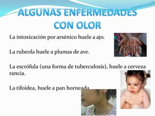 La intoxicación por arsénico huele a ajo.

La rubeola huele a plumas de ave.

La escrófula (una forma de tuberculosis), huele a cerveza
rancia.

La tifoidea, huele a pan horneada
 