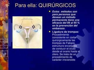 Para ella: QUIRÚRGICOS Estos  métodos son para personas que desean un método permanente tiene una eficacia del 99 al 95 % en la prevención del  embarazo. Ligadura de trompas:  Procedimiento consistente en cortar quirúrgicamente las trompas de Falopio, estructura encargada de conducir el óvulo desde el ovario hasta el útero. Se trata de un procedimiento de carácter irreversible  