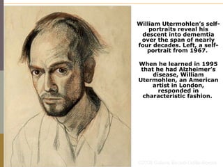 William Utermohlen’s self-
                portraits reveal his
             descent into dememtia
             over the span of nearly
            four decades. Left, a self-
               portrait from 1967.

            When he learned in 1995
             that he had Alzheimer’s
                 disease, William
            Utermohlen, an American
                 artist in London,
                   responded in
              characteristic fashion.




LEAD, ‘10   ©2006 Galerie Beckel-Odille-Boicos
 