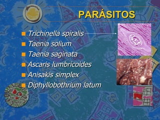 PARÁSITOS <ul><li>Trichinella spiralis </li></ul><ul><li>Taenia solium </li></ul><ul><li>Taenia saginata </li></ul><ul><li...