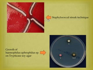  Staphylococcal streak technique
Growth of
haemophilus aphrophilus sp.
on Trypticase soy agar
 