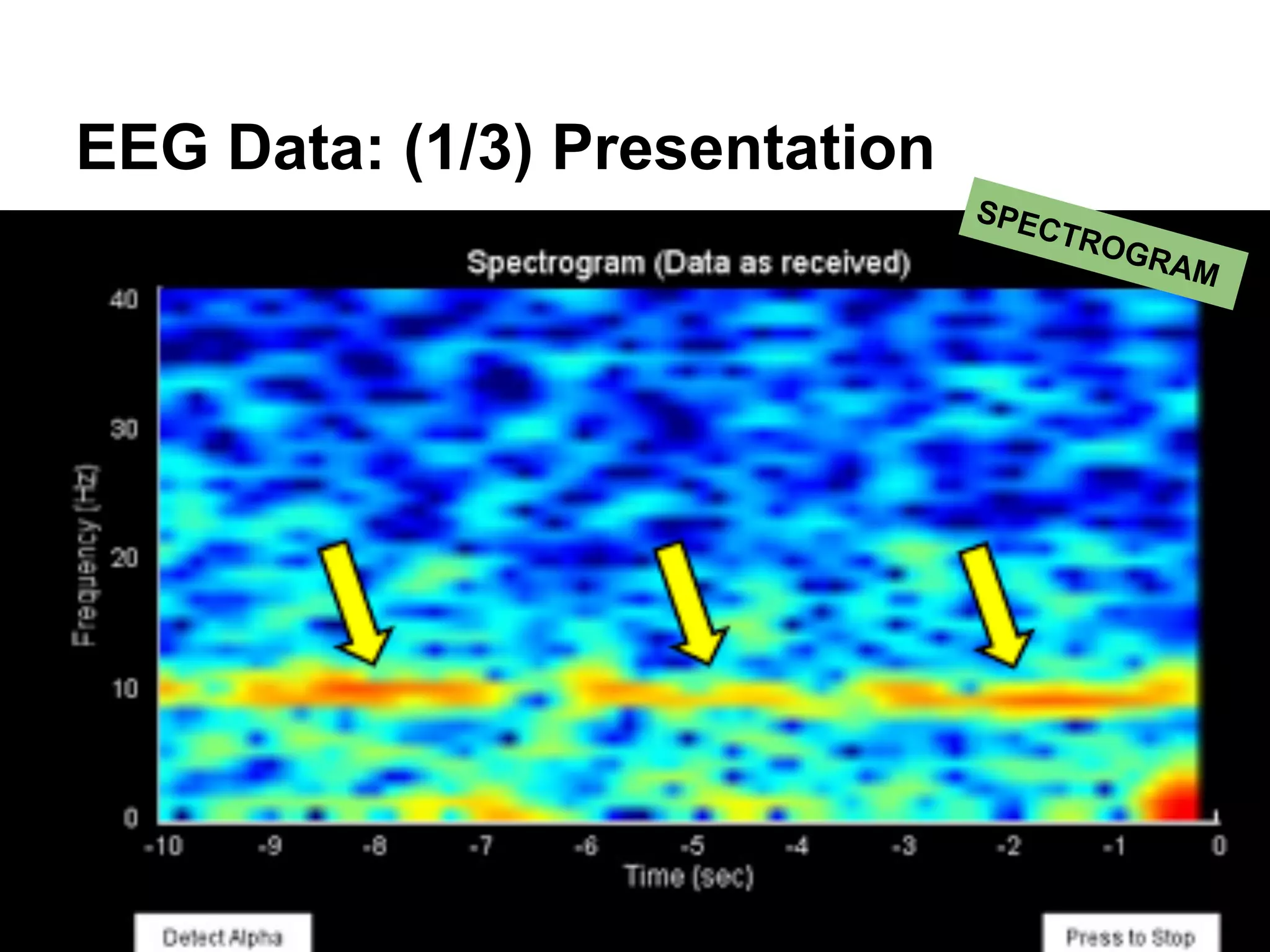 EEG Data: (1/3) Presentation
SPECTROGRAM
 