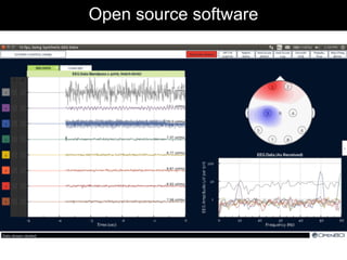 Open source software
 