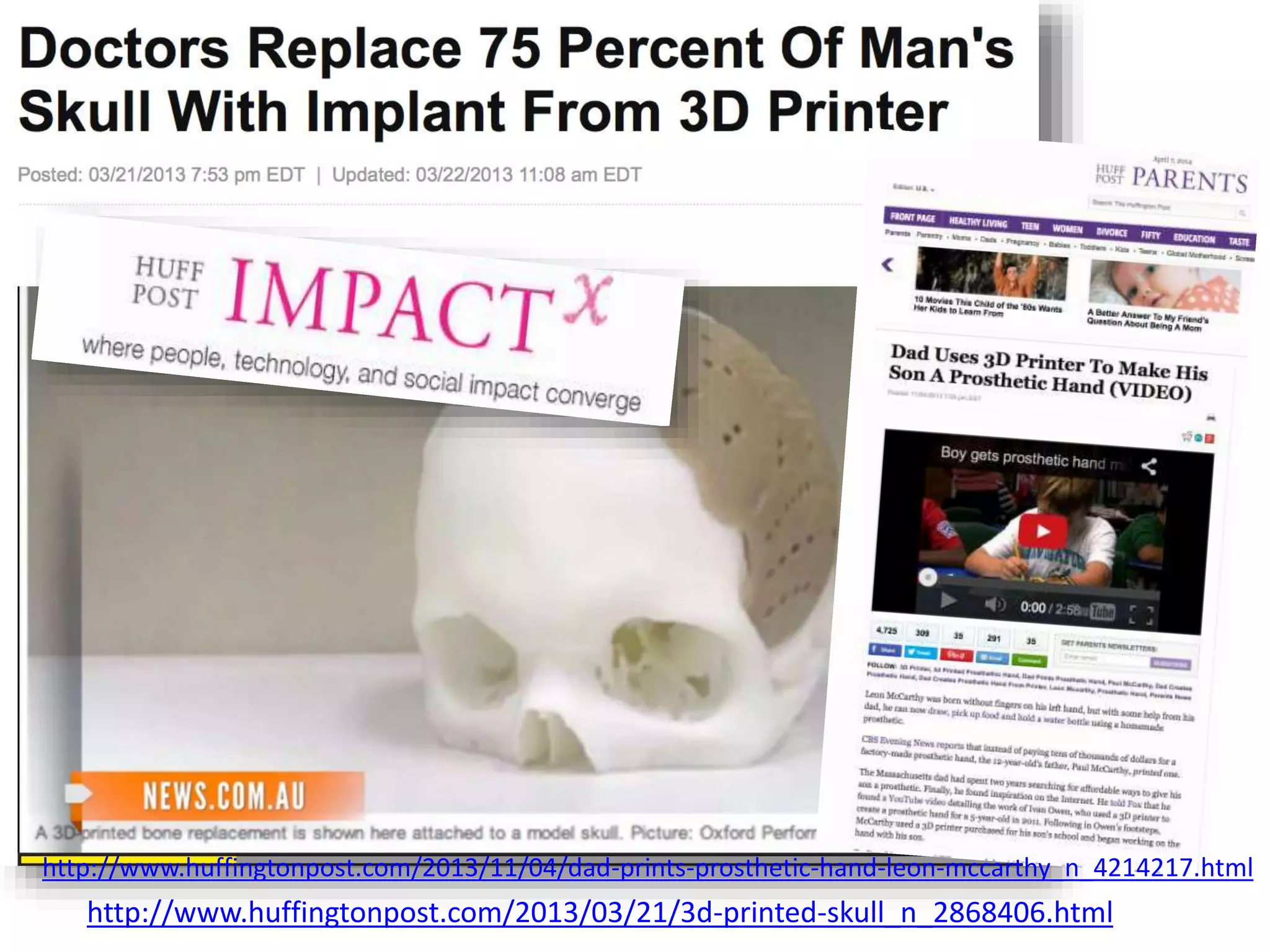 http://www.huffingtonpost.com/2013/03/21/3d-printed-skull_n_2868406.html
http://www.huffingtonpost.com/2013/11/04/dad-prints-prosthetic-hand-leon-mccarthy_n_4214217.html
 