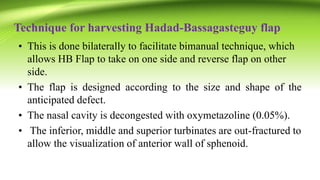 Technique for harvesting Hadad-Bassagasteguy flap
• This is done bilaterally to facilitate bimanual technique, which
allows HB Flap to take on one side and reverse flap on other
side.
• The flap is designed according to the size and shape of the
anticipated defect.
• The nasal cavity is decongested with oxymetazoline (0.05%).
• The inferior, middle and superior turbinates are out-fractured to
allow the visualization of anterior wall of sphenoid.
 