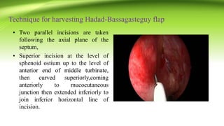Technique for harvesting Hadad-Bassagasteguy flap
• Two parallel incisions are taken
following the axial plane of the
septum,
• Superior incision at the level of
sphenoid ostium up to the level of
anterior end of middle turbinate,
then curved superiorly,coming
anteriorly to mucocutaneous
junction then extended inferiorly to
join inferior horizontal line of
incision.
 