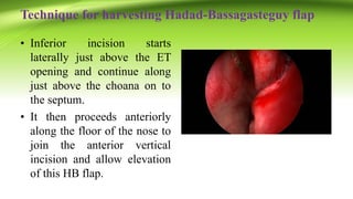 Technique for harvesting Hadad-Bassagasteguy flap
• Inferior incision starts
laterally just above the ET
opening and continue along
just above the choana on to
the septum.
• It then proceeds anteriorly
along the floor of the nose to
join the anterior vertical
incision and allow elevation
of this HB flap.
 
