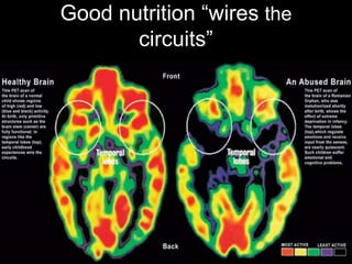 Good nutrition “wires the
circuits”
 