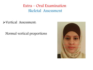 Extra – Oral Examination
Skeletal Assessment
Vertical Assessment:
Normal vertical proportions
 