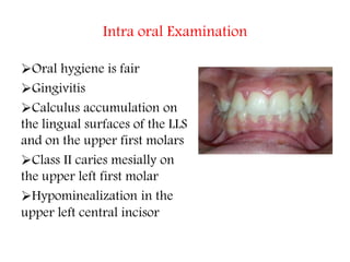 Intra oral Examination
Oral hygiene is fair
Gingivitis
Calculus accumulation on
the lingual surfaces of the LLS
and on the upper first molars
Class II caries mesially on
the upper left first molar
Hypominealization in the
upper left central incisor
 