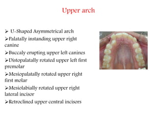 Upper arch
 U-Shaped Asymmetrical arch
Palatally instanding upper right
canine
Buccaly erupting upper left canines
Distopalatally rotated upper left first
premolar
Mesiopalatally rotated upper right
first molar
Mesiolabially rotated upper right
lateral incisor
Retroclined upper central incisors
 