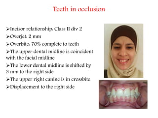 Teeth in occlusion
Incisor relationship: Class II div 2
Overjet: 2 mm
Overbite: 70% complete to teeth
The upper dental midline is coincident
with the facial midline
The lower dental midline is shifted by
3 mm to the right side
The upper right canine is in crossbite
Displacement to the right side
 