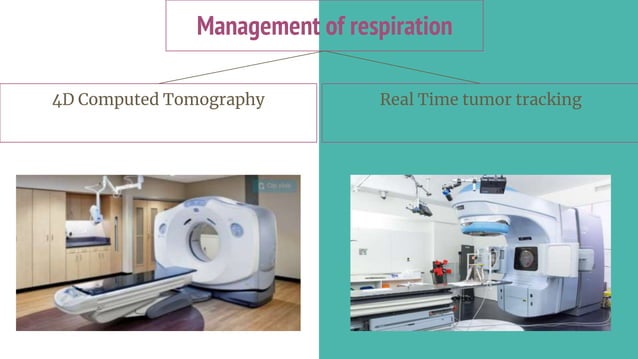 Motion in Hadron therapy (radiotherapy) | PPTX | Lung and Respiratory ...