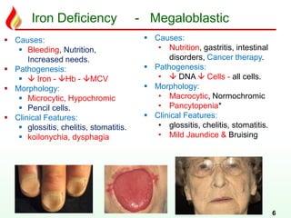 Iron Deficiency - Megaloblastic
6
 Causes:
 Bleeding, Nutrition,
Increased needs.
 Pathogenesis:
  Iron - Hb - MCV
 Morphology:
 Microcytic, Hypochromic
 Pencil cells.
 Clinical Features:
 glossitis, chelitis, stomatitis.
 koilonychia, dysphagia
 Causes:
• Nutrition, gastritis, intestinal
disorders, Cancer therapy.
 Pathogenesis:
•  DNA  Cells - all cells.
 Morphology:
• Macrocytic, Normochromic
• Pancytopenia*
 Clinical Features:
• glossitis, chelitis, stomatitis.
• Mild Jaundice & Bruising
 