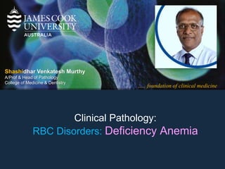 ….. foundation of clinical medicine
Shashidhar Venkatesh Murthy
A/Prof & Head of Pathology
College of Medicine & Dentistry
Clinical Pathology:
RBC Disorders: Deficiency Anemia
 