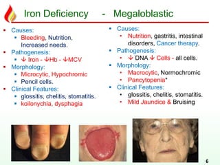 Iron Deficiency - Megaloblastic
6
 Causes:
 Bleeding, Nutrition,
Increased needs.
 Pathogenesis:
  Iron - Hb - MCV
 Morphology:
 Microcytic, Hypochromic
 Pencil cells.
 Clinical Features:
 glossitis, chelitis, stomatitis.
 koilonychia, dysphagia
 Causes:
• Nutrition, gastritis, intestinal
disorders, Cancer therapy.
 Pathogenesis:
•  DNA  Cells - all cells.
 Morphology:
• Macrocytic, Normochromic
• Pancytopenia*
 Clinical Features:
• glossitis, chelitis, stomatitis.
• Mild Jaundice & Bruising
 