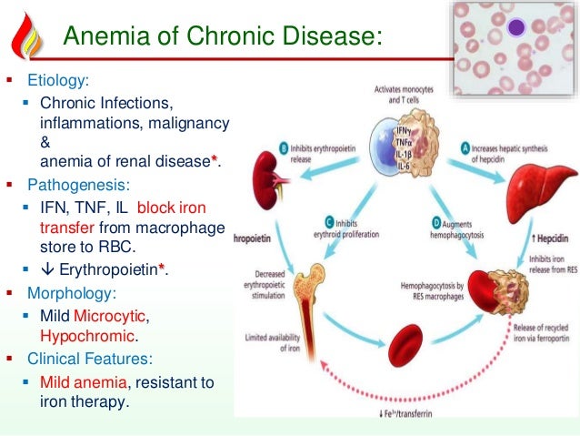 Anemia2 deficiency anemias