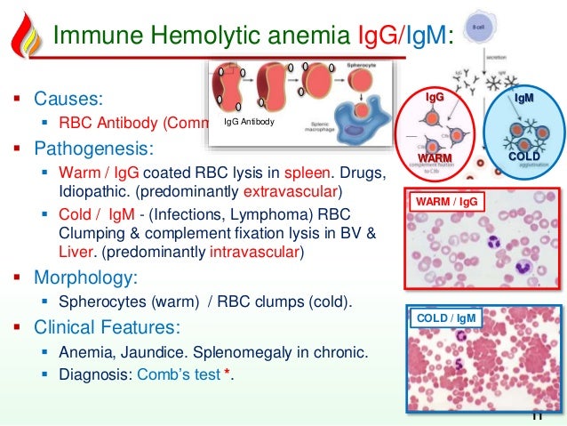 autoimmune hemolytic anemia essay Anemia and hemolytic anemia essay or multiple myeloma problems with the immune system that cause the destruction of blood cells (hemolytic anemia. autoimmune hemolytic anemia essay Anemia and hemolytic anemia essay or multiple myeloma problems with the immune system that cause the destruction of blood cells (hemolytic anemia.