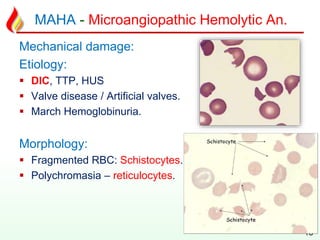 MAHA - Microangiopathic Hemolytic An.
Mechanical damage:
Etiology:
 DIC, TTP, HUS
 Valve disease / Artificial valves.
 March Hemoglobinuria.
Morphology:
 Fragmented RBC: Schistocytes.
 Polychromasia – reticulocytes.
13
 