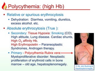 Polycythemia: (high Hb)
 Relative or spurious erythrocytosis
 Dehydration: Diarrhea, vomiting, diuretics,
excess alcohol. etc.
 Absolute erythrocytosis (True ):
 Secondary: Tissue Hypoxia: Smoking (CO),
High altitude, Lung disease. Cardiac shunts,
High O2 affinity Hb.
High Erythropoietin – Paraneoplastic
Syndromes, Androgen therapy.
 Primary - Polycythemia Rubra vera:
Myeloproliferative disorder: Neoplastic
proliferation of erythroid cells in bone
marrow – old age, hepatosplenomegaly.
10
 Hb, skin flushing &
Hepatosplenomegaly
 