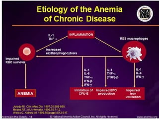 Haem15 - Anemia conclusions & Polycythemia