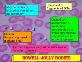 May be centrally
located or sometimes in
the periphery

Staining :
Romanowsy (eosinmetilena blue)

Composed of
fragments of DNA

Caused by
acceleration /
ineffective
erythropoiesis in
which chromosome
fragments are left
in the cytoplasm

Disorder : splenectomy and in thalassemia
, hemolytic anemia

HOWELL-JOLLY BODIES

 