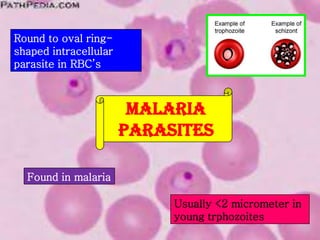 Round to oval ringshaped intracellular
parasite in RBC’s

MALARIA
PARASITES
Found in malaria
Usually <2 micrometer in
young trphozoites

 