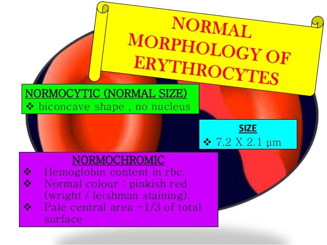 Normal And Abnormalities In Red Blood Cell - 638x479 - jpeg Abnormal Red Blood Cell Size