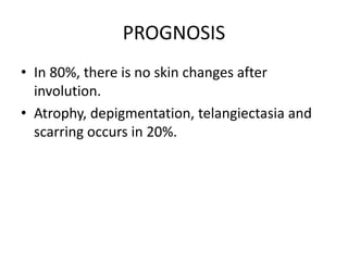 Haemangioma of infancy | PPTX