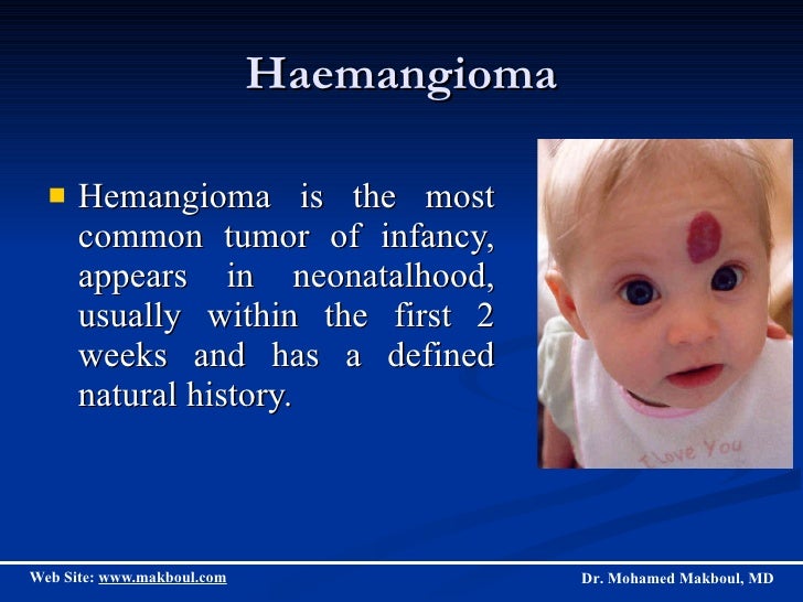 Haemangiomas And Vascular Malformations