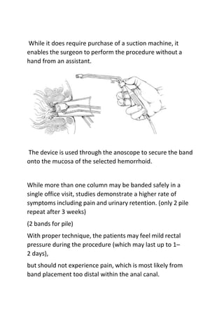 While it does require purchase of a suction machine, it
enables the surgeon to perform the procedure without a
hand from an assistant.
The device is used through the anoscope to secure the band
onto the mucosa of the selected hemorrhoid.
While more than one column may be banded safely in a
single office visit, studies demonstrate a higher rate of
symptoms including pain and urinary retention. (only 2 pile
repeat after 3 weeks)
(2 bands for pile)
With proper technique, the patients may feel mild rectal
pressure during the procedure (which may last up to 1–
2 days),
but should not experience pain, which is most likely from
band placement too distal within the anal canal.
 